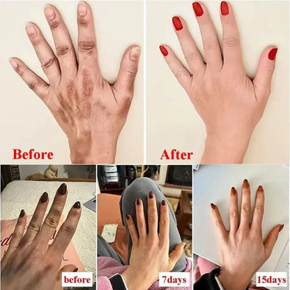 Anti-Wrinkle Hand Cream with Coconut Oil – Moisturizing Skin Care Serum